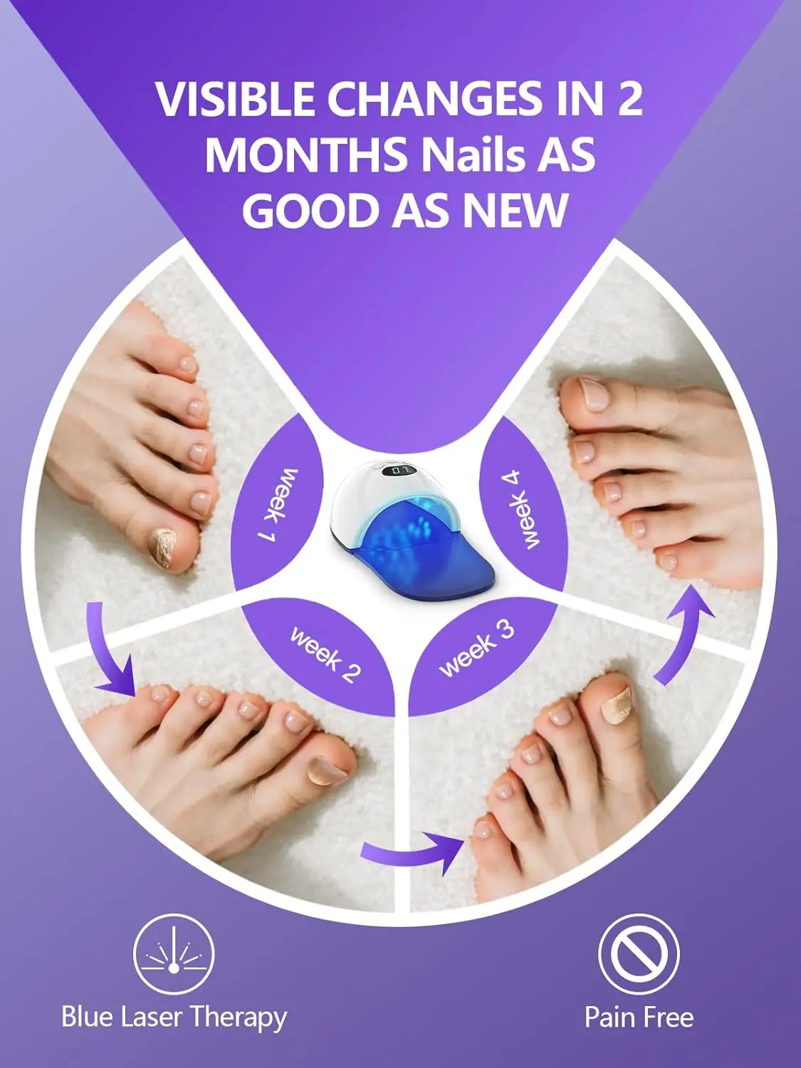 48W Nail Fungus Light Therapy Device 30pcs LED 460nm Blue Light Fungal Treatment Device for Onychomycosis Damaged Discoloured Thick Toenail&Fingernail