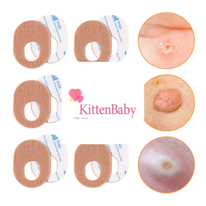 

New Felt Corns Self-adhesive Sticker Preventing Calluses Pain Abrasion Protective Patch Heel Sticker