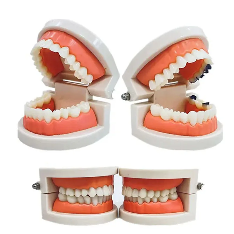 

Standard Teaching Model Dental Model Teeth Model Education Demo For Dentist Patient Students Studying Display