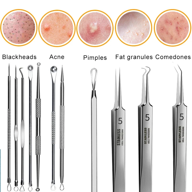 2/3/4/5/8pcs Blackhead Remover Pimple Popper Tool Kit Professional Pimples Comedone Extractor Removal Tool Ingrown Hair Tweezers