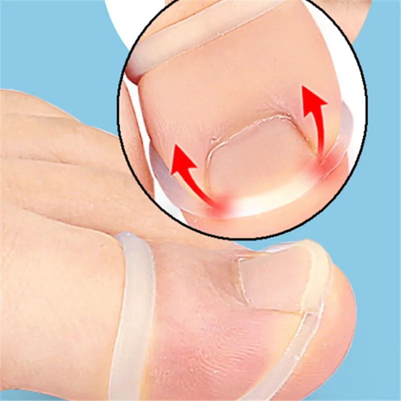 1 قطعة جديد سيليكون نام أظافر تصحيح غير مرئية نام تو إصبع مسمار استقامة حامي هدفين باديكير الرعاية أداة #1