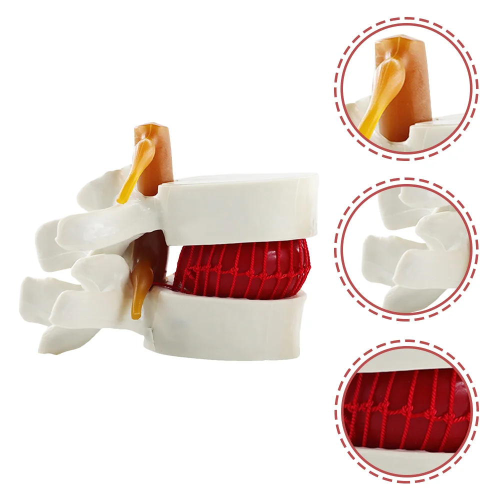 Anatomy Model for Chiropractor Manikin Intervertebral Disc Models Lumbar Vertebrae Degenerative Spine Demonstrating