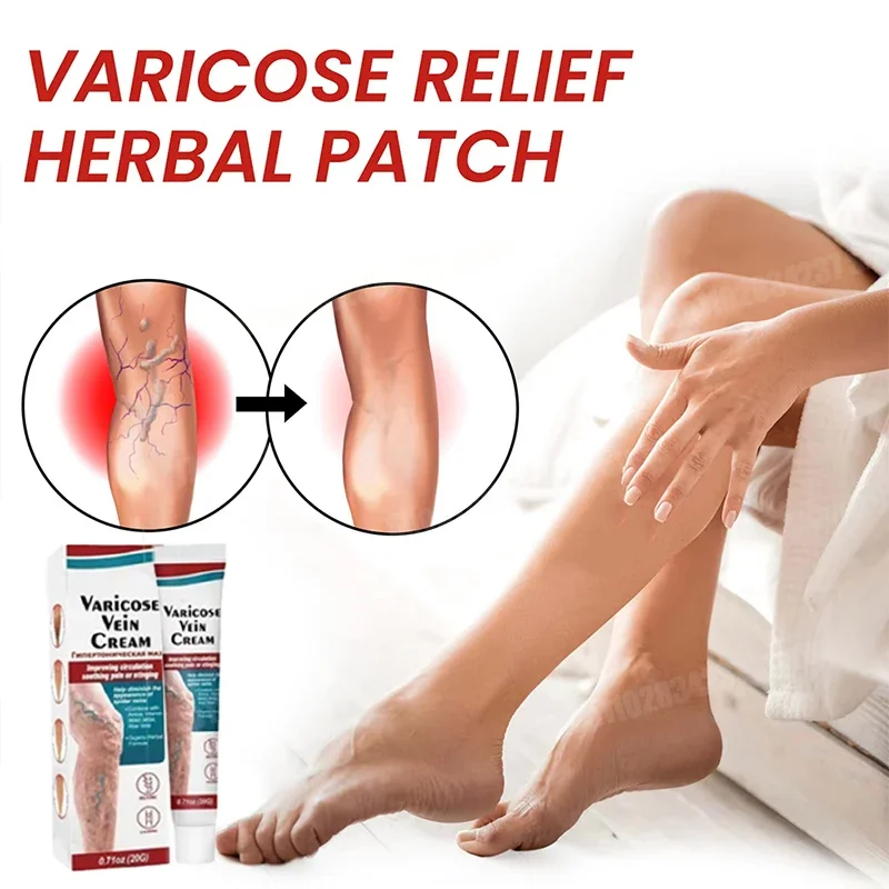 100%Original Vasculitis Blood Circulation Varicose Veins Treatment New Cream