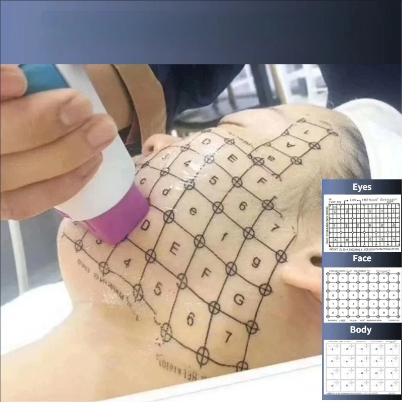 

Grid RF Machine Face Skin Marking Paper