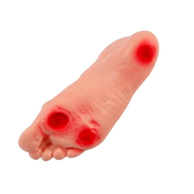 Advanced diabetic foot care model Lesion ulceration foot care training model