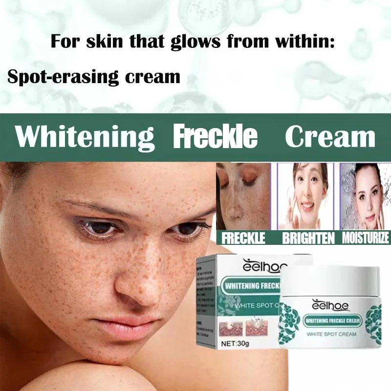 EELHOE نيكوتيناميد النمش كريم مزيل الكلف كريم إزالة التصبغ ترطيب مصل إزالة البقع الداكنة