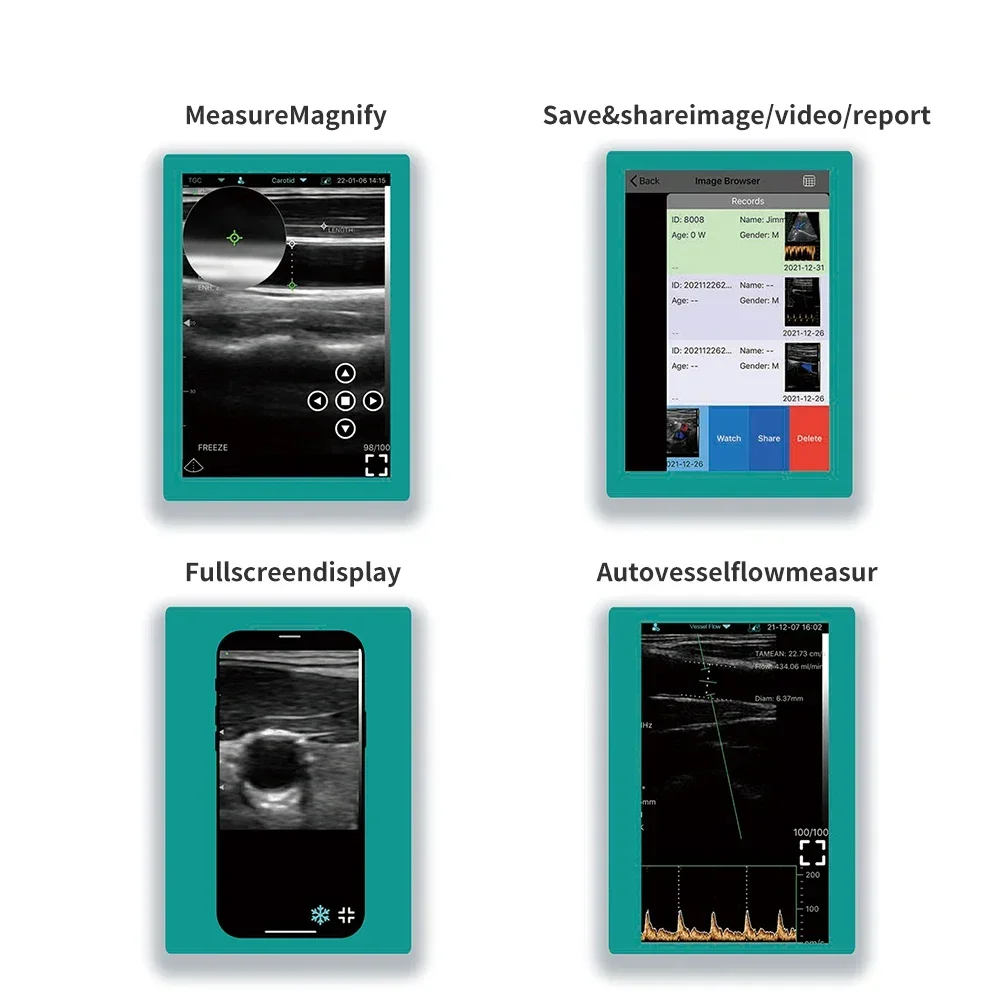 128E Wireless Cardiovascular Ultrasound Multipurpose Dual Head Linear+Cardiac Ultrasound Probe Support IOS Android Windows