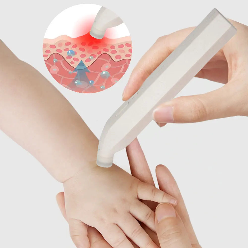 

Electronic Mosquito Bite Pen Natural Electric Insect Bite Healer Anti-Itch Pen for Adult Children for Camping Travel Outdoor