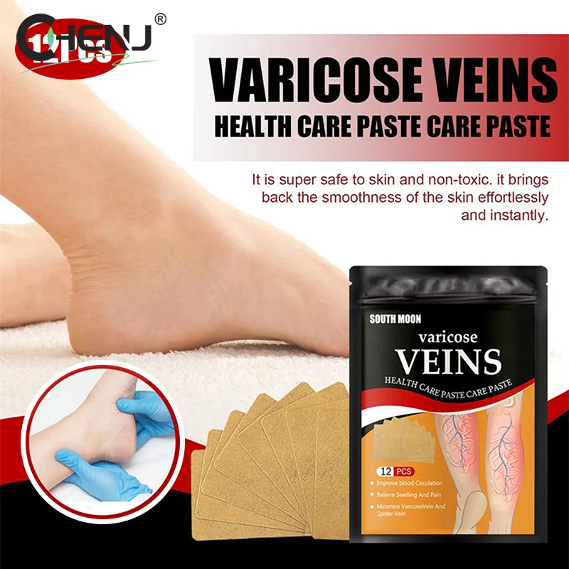 12PCS Unisex Varicose Veins Treatment Patch Legs Sore Swelling Plaster Promote Metabolism Promote Smooth Blood Circulation