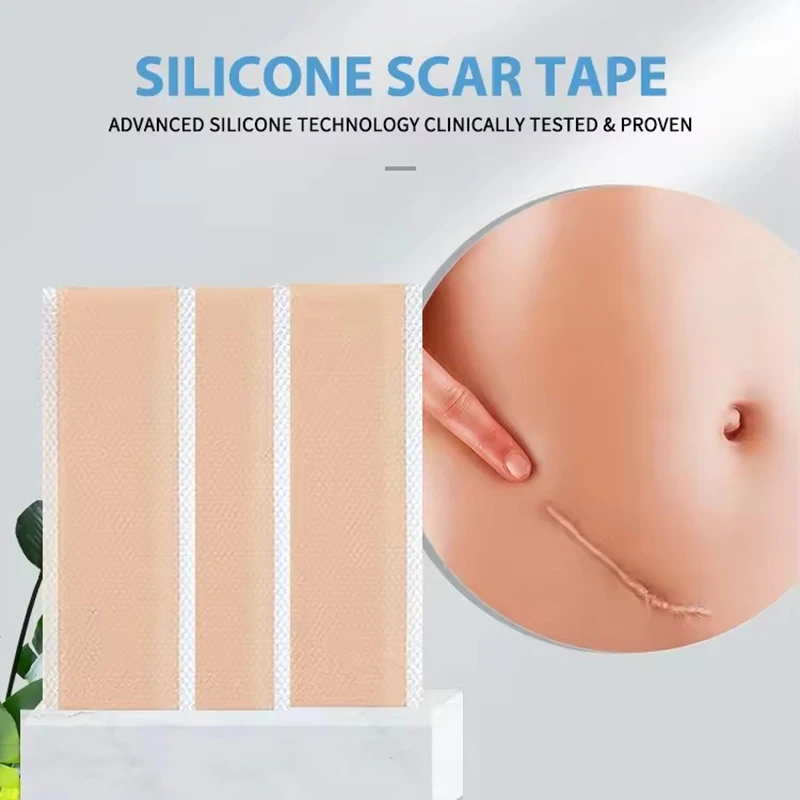 Silicone Scar Tape For Surgical Scars Medical Grade Silicone Scar Sheet Painless Effective Scar Repair Tape