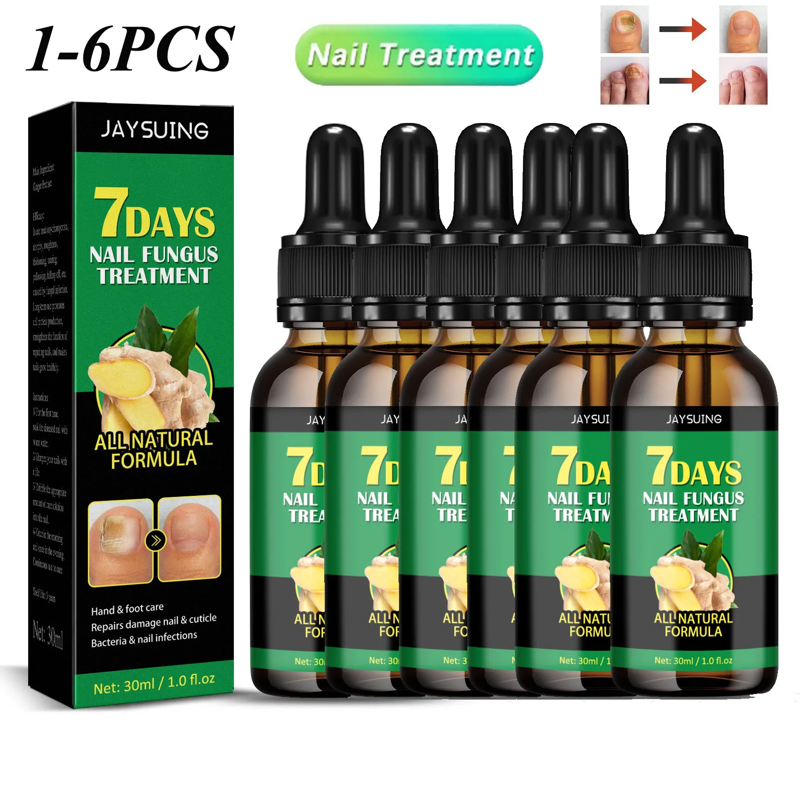 1-6 Stuks 30Ml Schimmel Nagel Behandeling Essence Olie Nagel Schimmel Laser Apparaat Reparatie Teennagel Vingernagel Behandeling Onychomycosis