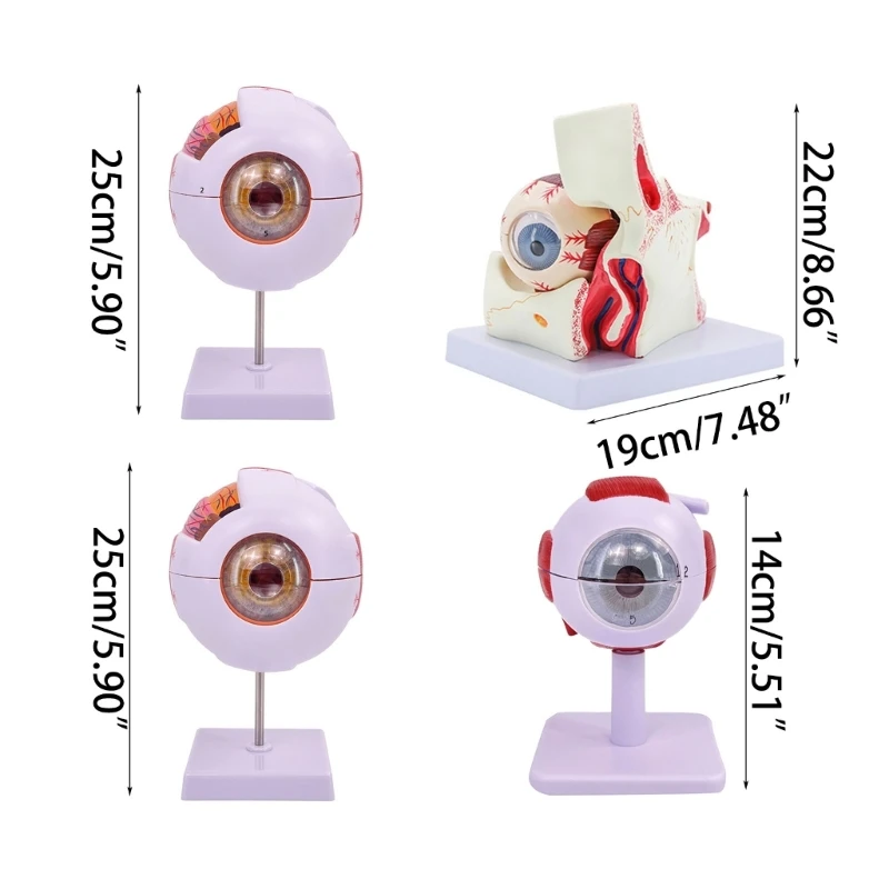 Eyeball Anatomy Model for Eye Diseases Study, 6X Human Eye Anatomy Model Eye Anatomy Model Human Organs Teaching Prop