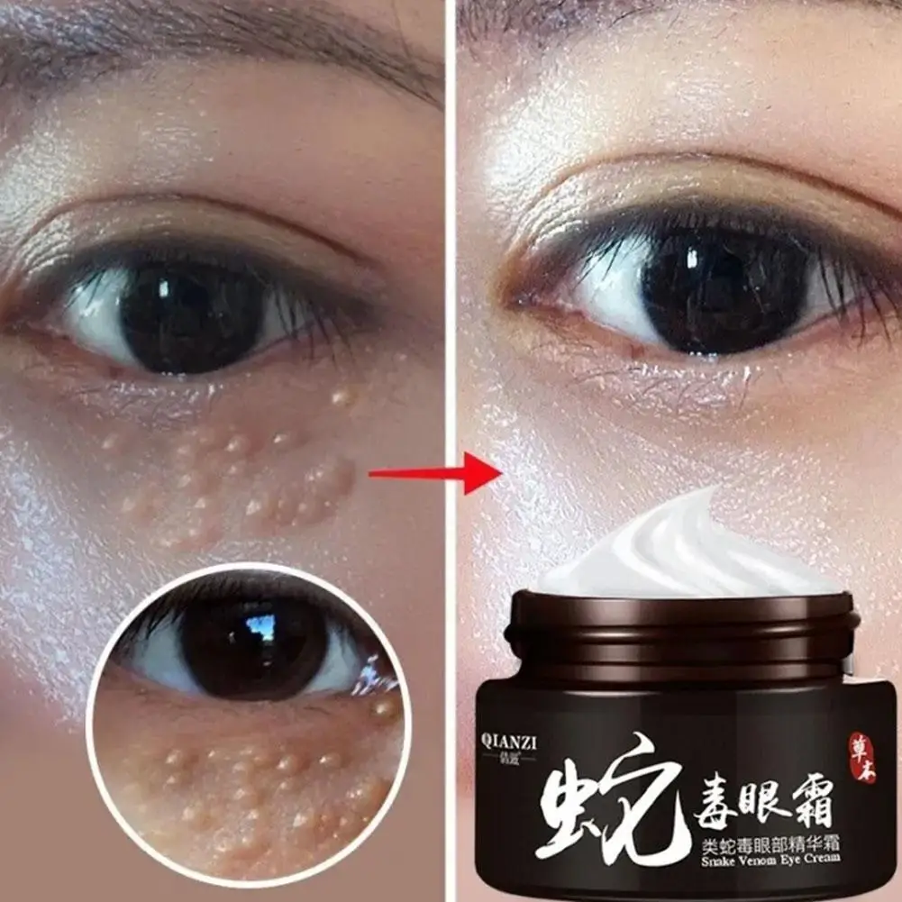 Crème anti-déformable pour les yeux, estompe les ridules, anti-poches foncées, élimine les poches sous les yeux, sérum anti-âge, soin optimiste pour les yeux, crème pour les vaches, 30g, J7G9