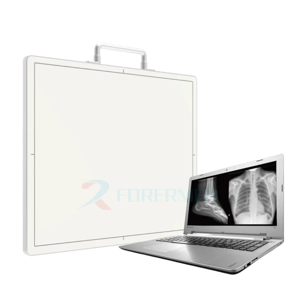 Medical DR flat Panel Detector X-ray 17*17 Portable Flat Panel Detector Inalambrico Digital Wireless DR FLAT PANEL DETECTOR