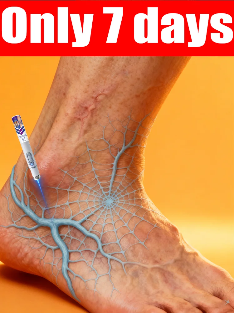 

Vᴀʀɪᴄᴏsᴇ ᴠᴇɪɴ ʟᴀsᴇʀ ɪɴsᴛʀᴜᴍᴇɴᴛ