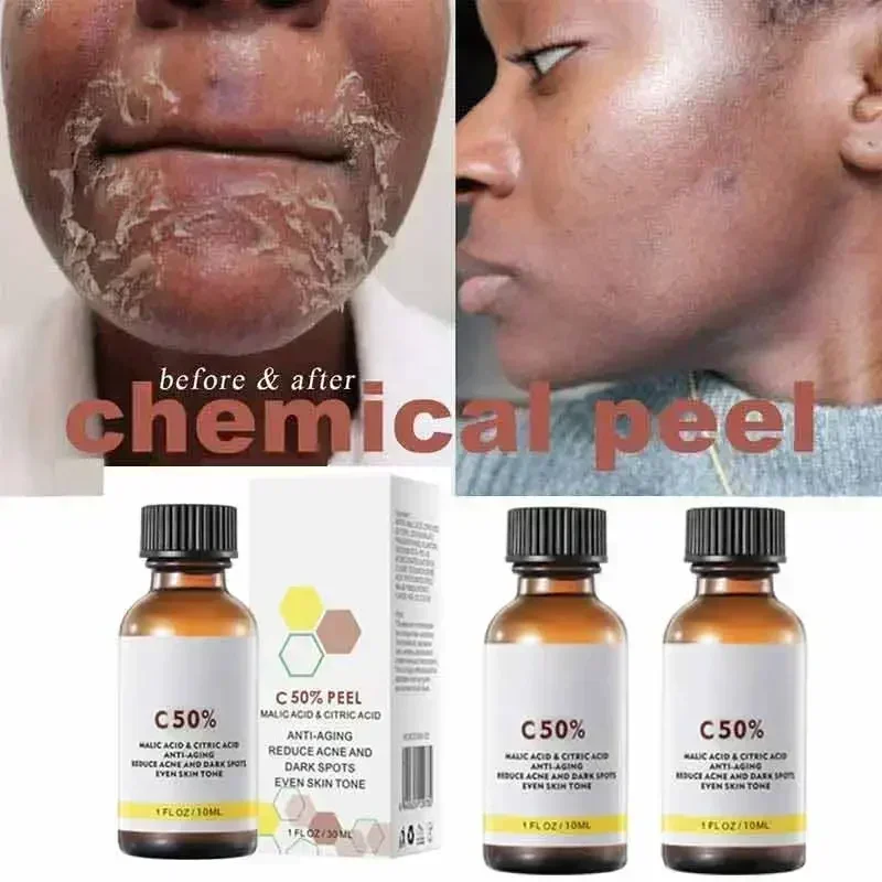 Cuidado facial exfoliante piel radiante desvanecimiento manchas oscuras y pigmentación para una piel uniforme más brillante eliminar manchas brazo rodilla piernas melanina