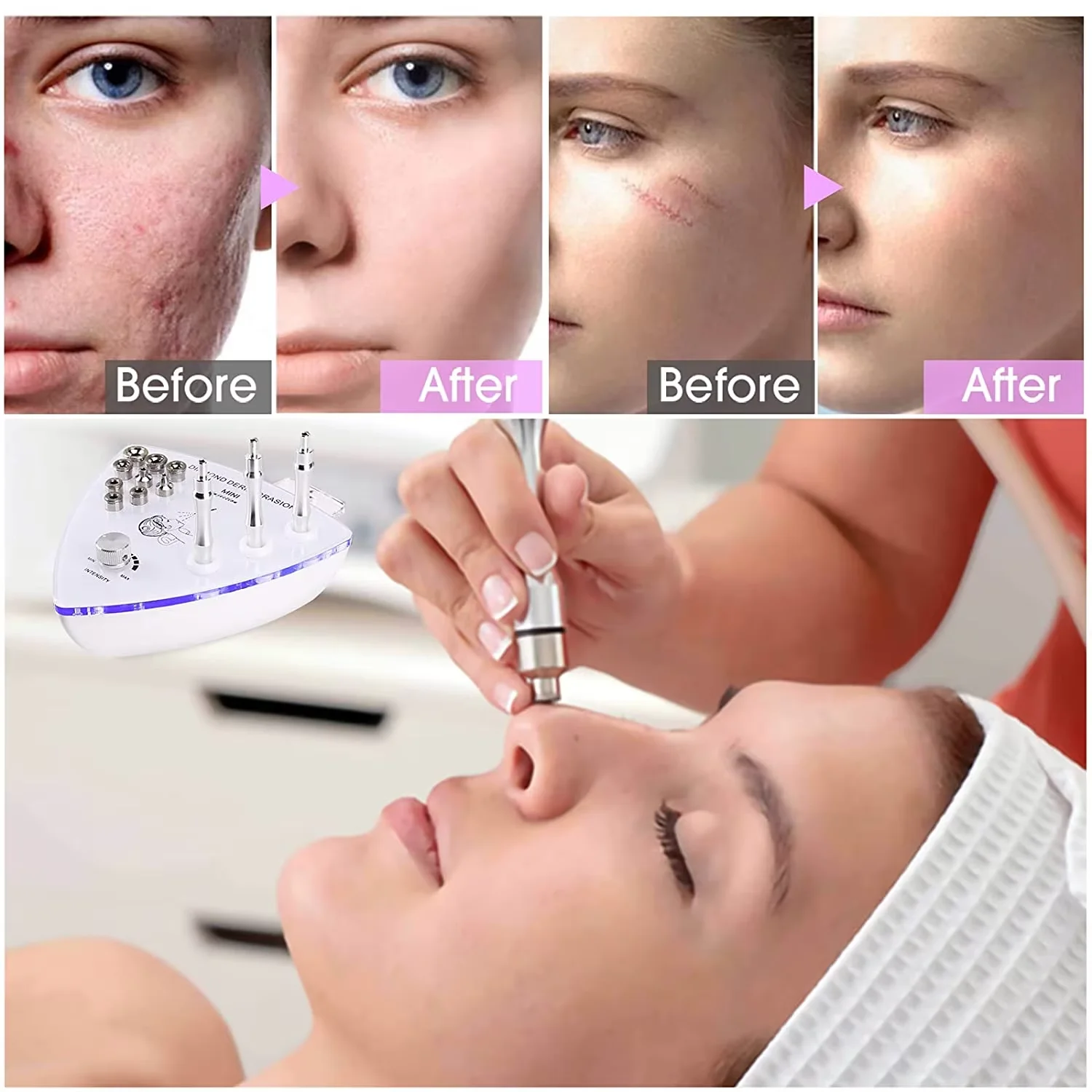 Draagbare Crystal Dermabrasie Kit Schoonheid Huidapparaat 3-in-1 Diamond Tip Microdermabrasie Vacuüm Mee-eter Gezichtsmachine