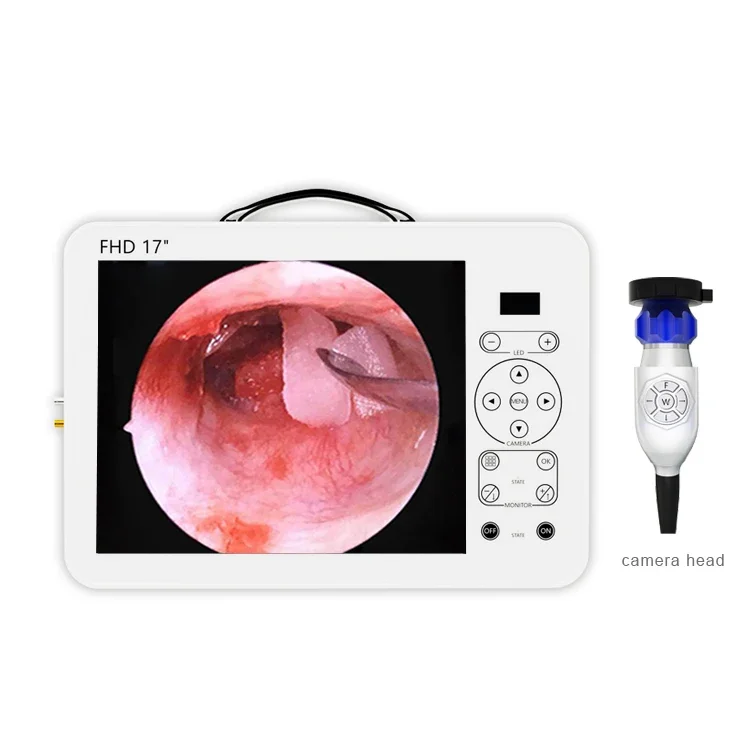 portable endoscopy machine with 1080p full hd equipment for laparoscopy hysteroscopi ent machine surgery