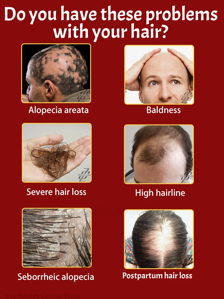 Thick hair is easy, say goodbye to baIdness, hair growth essence oiI