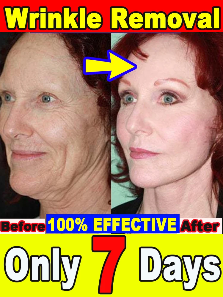 

Молодший 100%