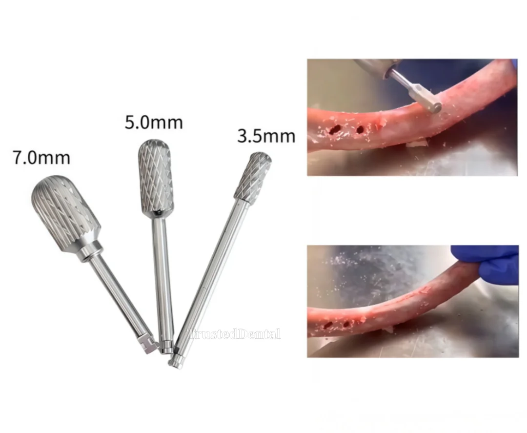 

Dental Trimming Drill Shaping Sculpting Bone Ridge Contouring Bur Ananas Drills