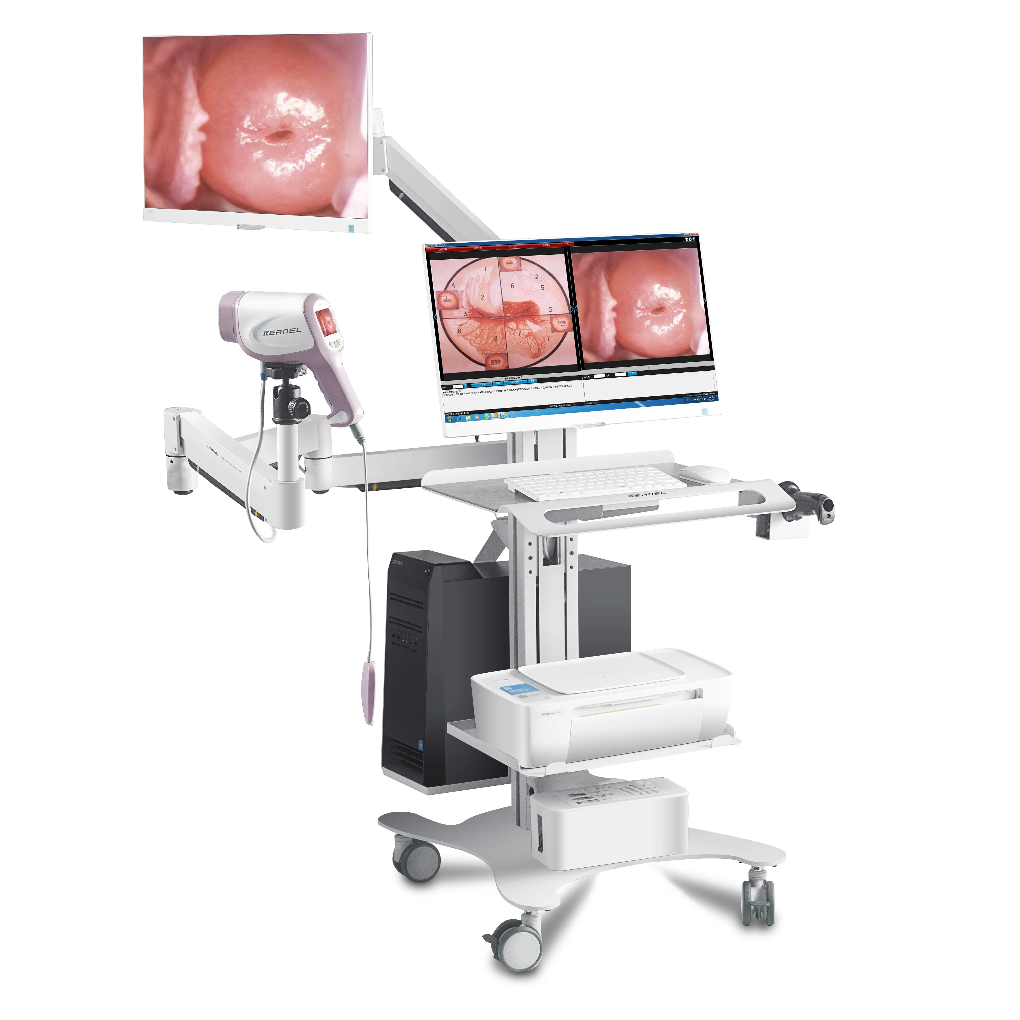 CE Approved Kernel KN-2200I(H) Full HD 1080P -Sony CCD digital Video Colposcope for gynecology