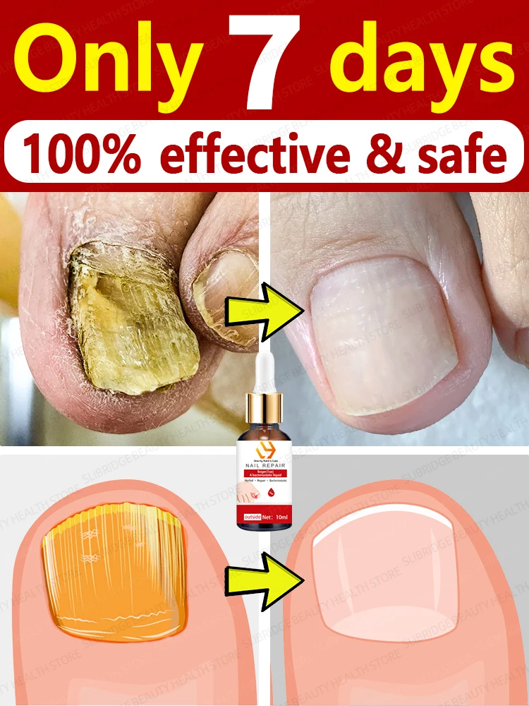 

Solve all nails problem