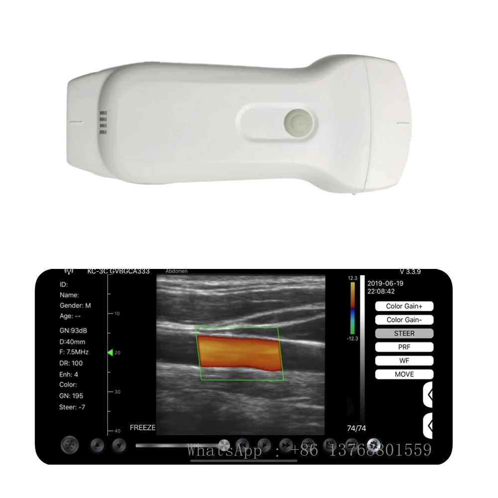

Беспроводной ультразвуковой зонд, ручной цветной Доплер с двойной головкой, 3 в 1, подключенное устройство Windows/Android/IOS, Wi-Fi или USB