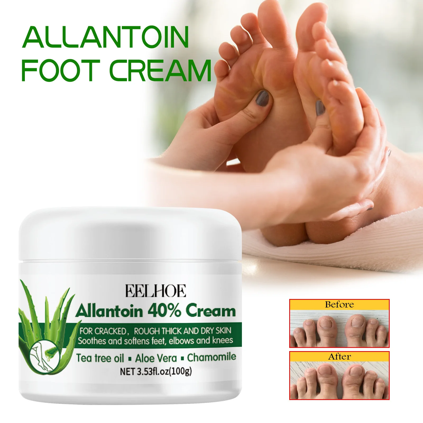 Foot Anti Dry Crack Cream(200g In Total)