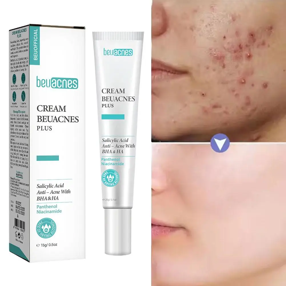 جديد 20 جرام نياسيناميد حب الشباب جل مكافحة حب الشباب حمض الساليسيليك لطيف التطهير هلام توازن الزيت التنظيف العميق منتجات العناية بالبشرة النساء