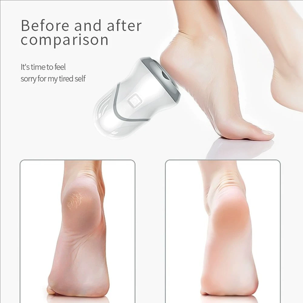 Elektrische Fuß Grinder Vakuum Adsorption Polieren Fuß Grinder Werkzeuge Fuß Schleifpapier Datei Abgestorbene Haut Kallus Entferner Pediküre