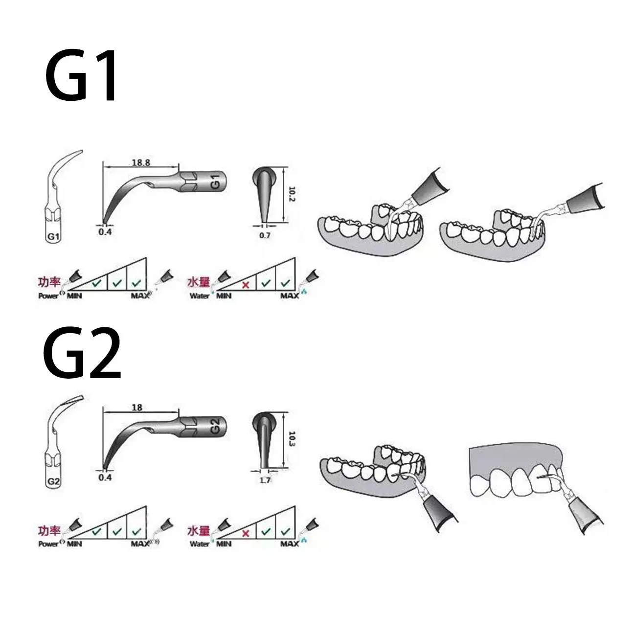5 pz Dentale Ad Ultrasuoni Scaler Punta Scaling Punta Periodonzia Endodonzia Fit Picchio EMS
