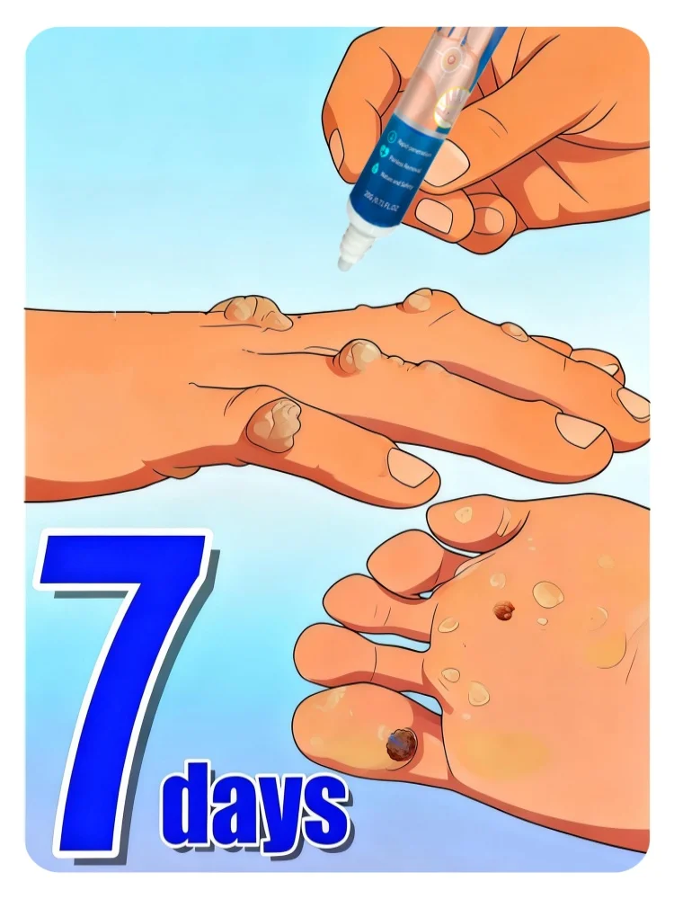 تقنية العناية بالبشرة 2025: وداعًا لخضراوات اليدين والقدمين والرقبة - للجنسين #1