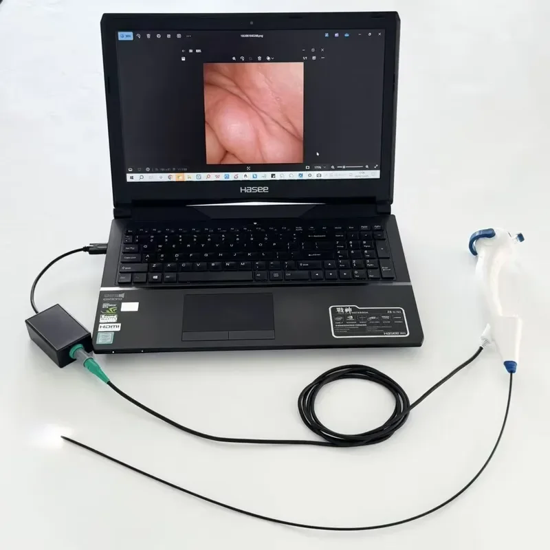 Mega Pixel USB Video Flexible Laryngoscope: 2.5–5.8mm, 30/60 cm, Electric Powered