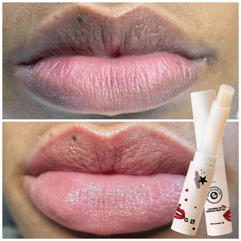 Lip Lightening Balm Repair Balm, Nourish Care, Fade Lips Lines, Base Hidratante, produtos poloneses maçantes