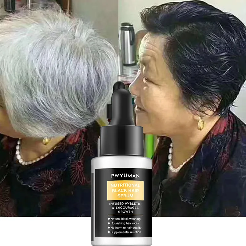 

Anti Gray Hair Essence Hair Blackening Serum White Hair Treatment White To Black Hair Repair Care Nourish Scalp Anti Hair Loss