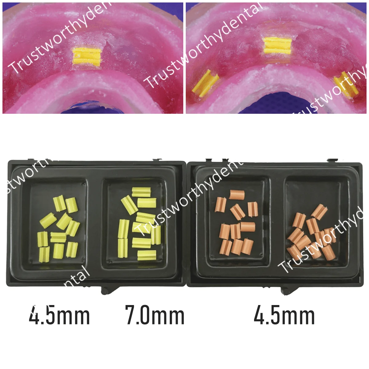 Dental Denture Hader Attachment Bar Clips Retention Overdenture Rider Hader Bar Short 4.5mm Long 7mm