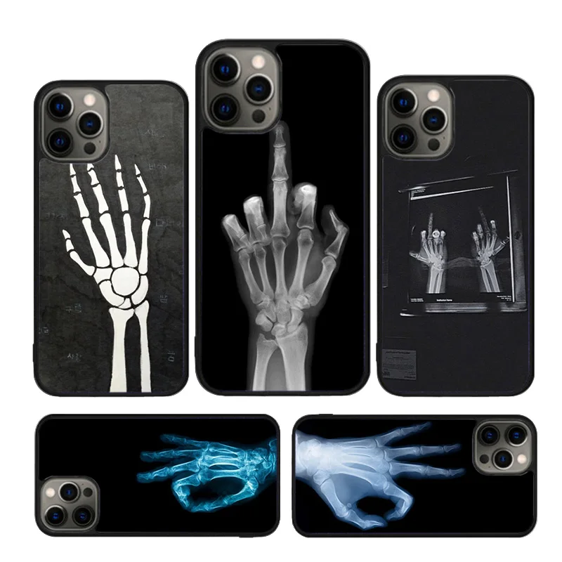 Autumu X-ray Hand Bones Phone Case For iPhone 16 15 13 14 11 12 Pro Max Max 6 7 8 Plus SE 2020 14 Back Cover