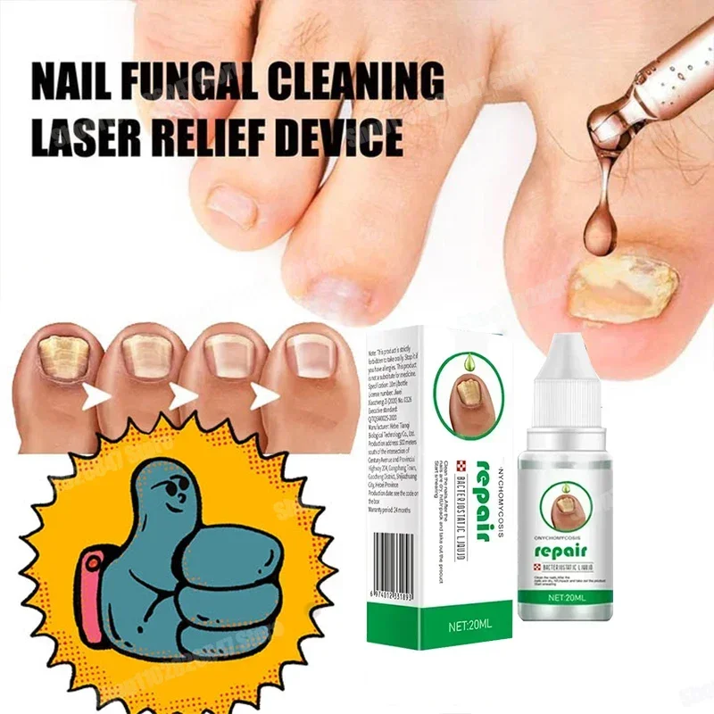 

Extra Nail Fungus Treatment Serum Essence oil Feet Nails Repair Care Essence Cream Anti Infection Toe Fungal Removal