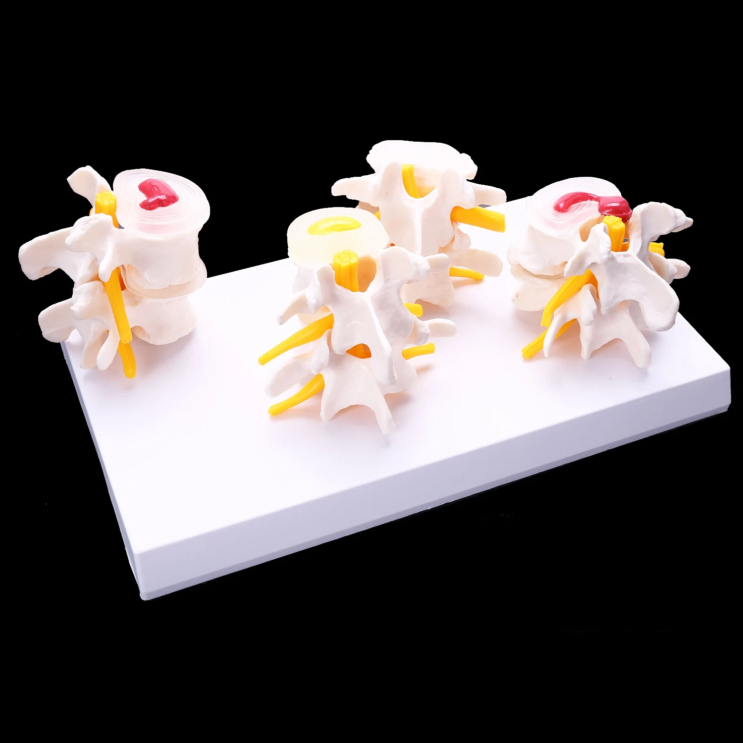 A56XQ Human Anatomy Skeleton Spine 4-Stages Lumbar Vertebral Model Brain Skull Traumatic Teaching Supplies