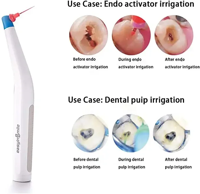 Mini head design Endodontic Irrigator Endo Activator Sonic Activator For Endodontic Irrigation