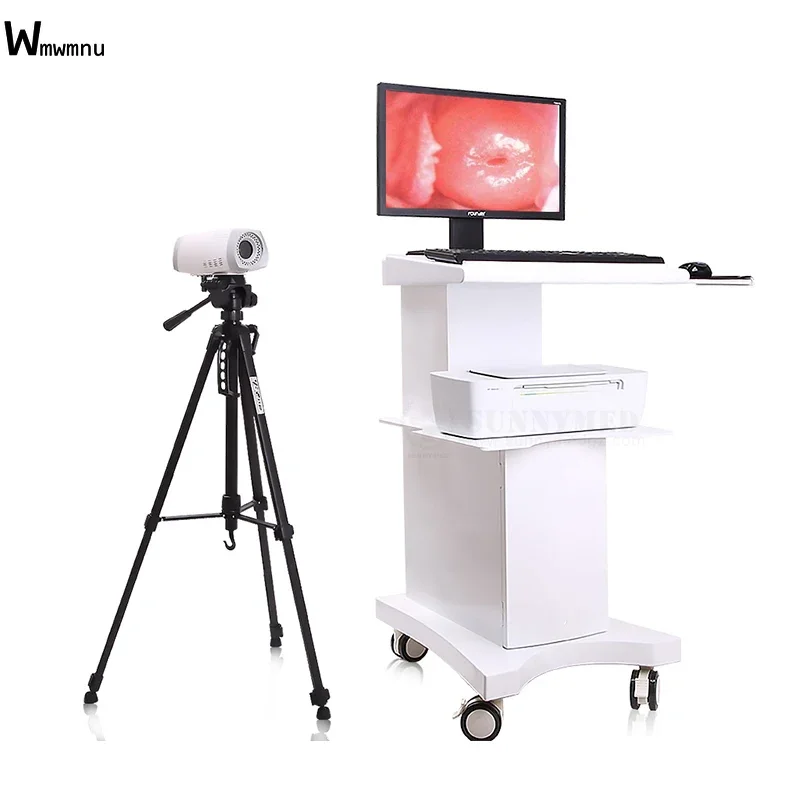 SUNNYMED SY-F004 Digital Video Portable Colposcope Medical Device