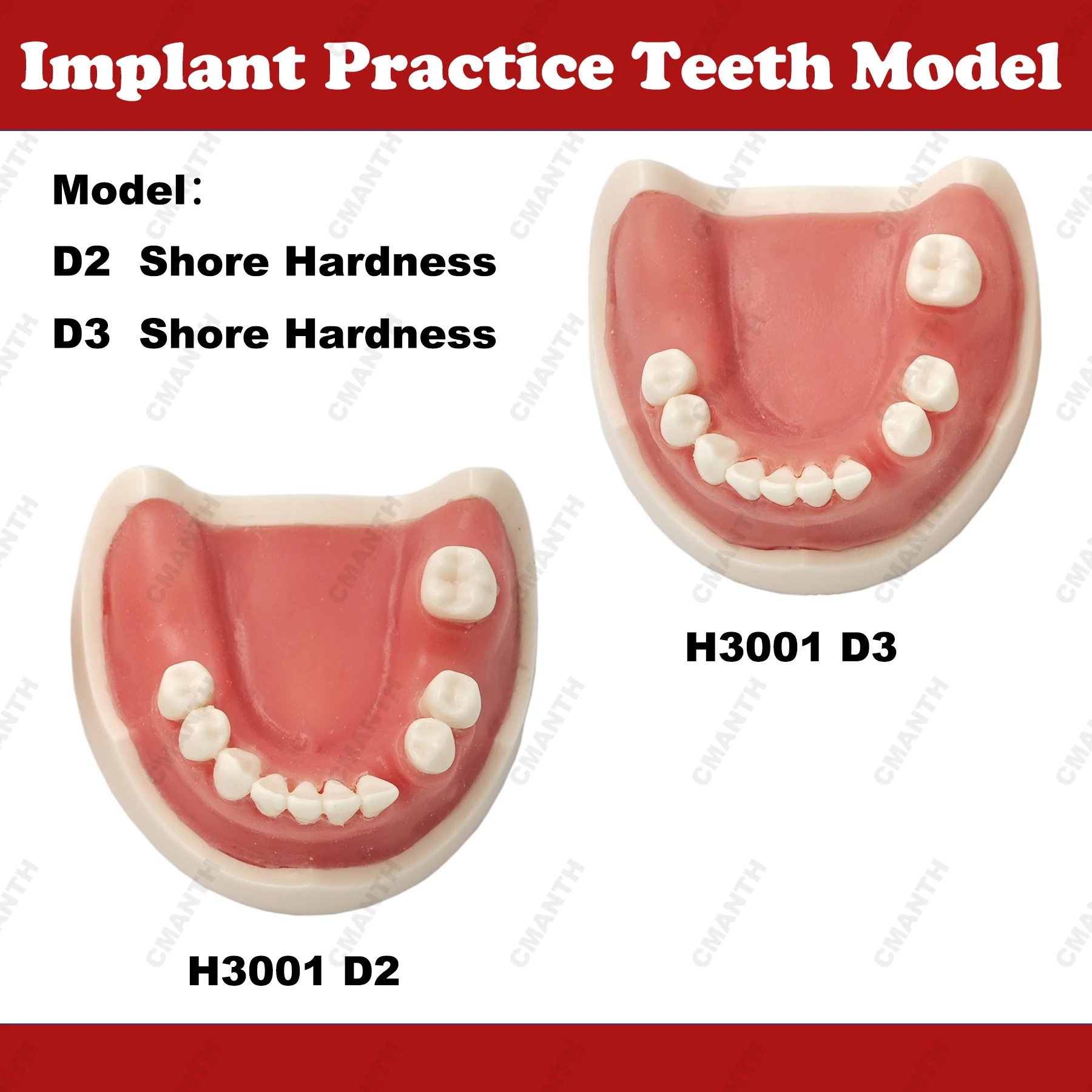 

Dental Implant Teeth Model Drilling Training Open Suture Model Selectable Hardness For Patient Education Demo Dentistry Products