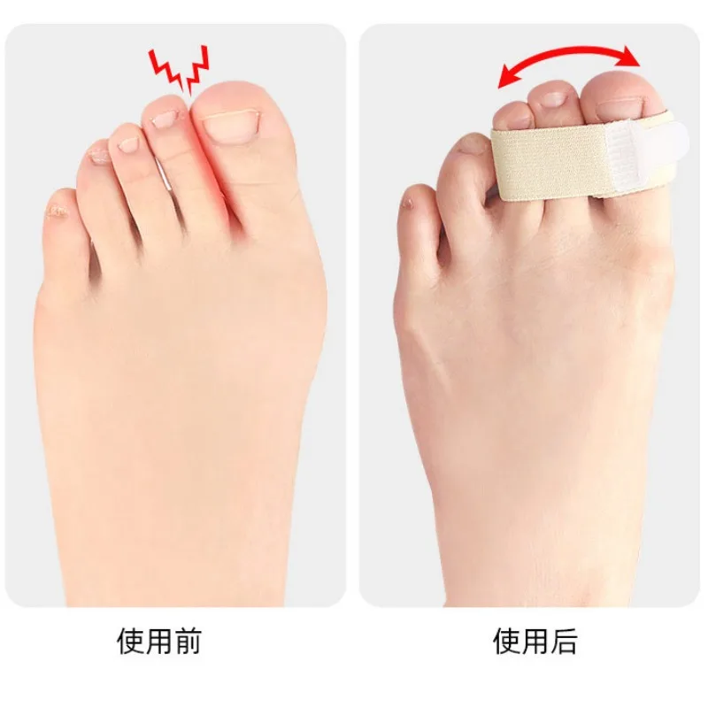 Hammer Toe Straight ener Toe Schienen kissen Bandagen zur Korrektur von krummen und überlappenden Zehen schutz für die persönliche Gesundheits versorgung