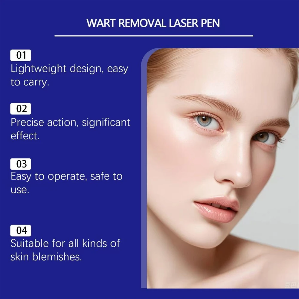 Newly upgraded blue laser pen for skin care, gently caring for every inch of your skin