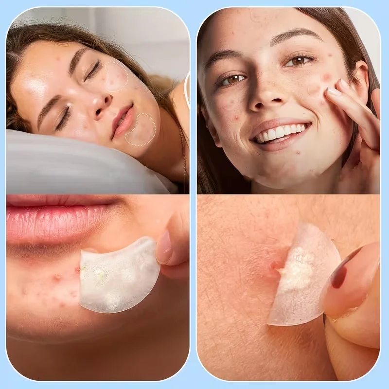 رقع بثرة كبيرة للوجه، رقع حب الشباب الغروانية المائية، أغطية زيت بأشكال متنوعة، قمر، شريط، مربع، مستطيل، شريط أنف