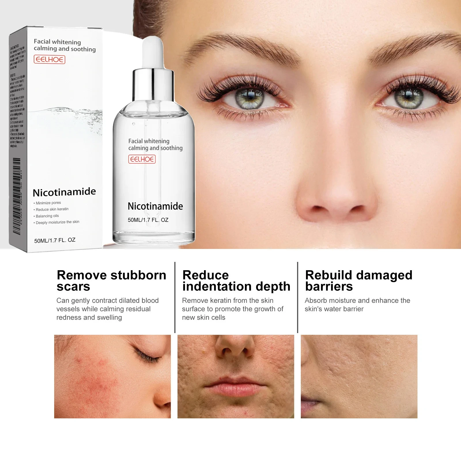 Niacinamide Face Serum Brightening Lighten Dark Spots Acne Marks Fade Blemishes Pigmentation Moisturizing Facial Essence