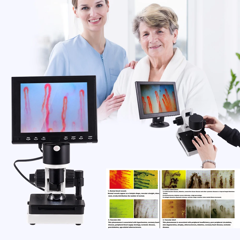 

380000 Pixels Clinic Use Biological Microcirculation Microscope Digital Microscope Capillary Microscope