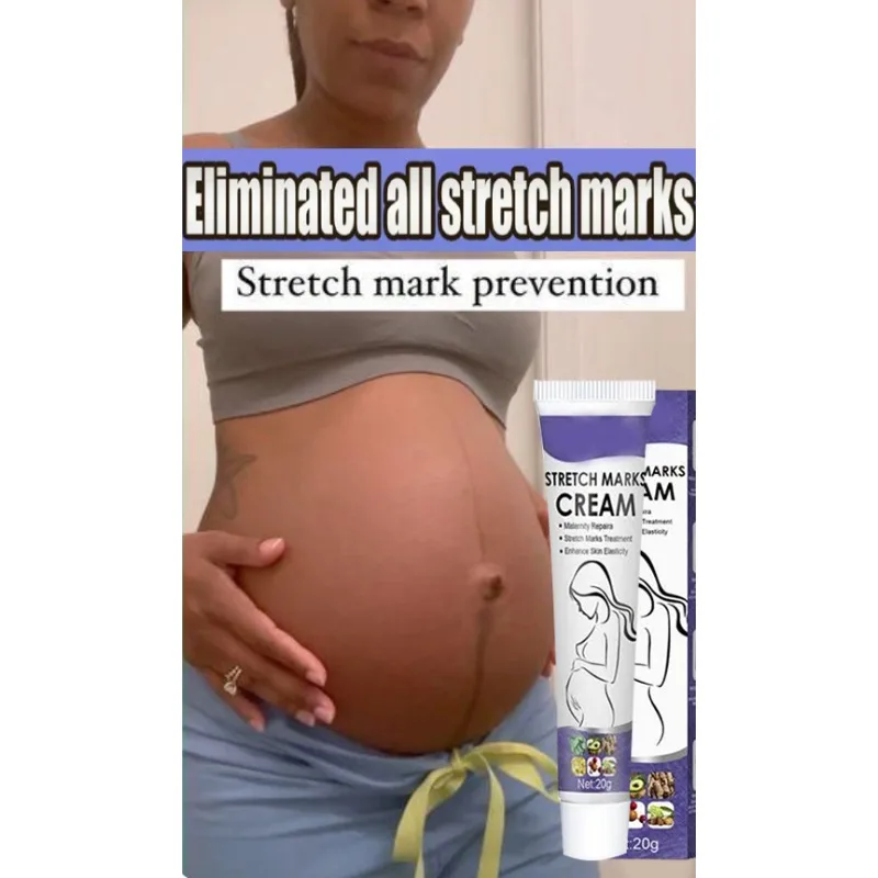 

ᴴᴼᵀ Gentle Skin Care Improves Elasticity Effective After Pregnancy Stretch Marks Removal Powerful Maternity Cream Nourishes Skin