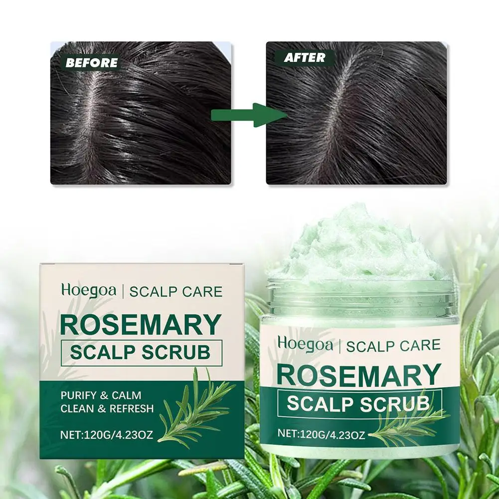 

Rosemary Scalp Exfoliaton Scrub Shampoo Scalp Hair Scalp Fresh Loss Control Oil Strengthen Hair Treatment And Roots Hair Re R3N4